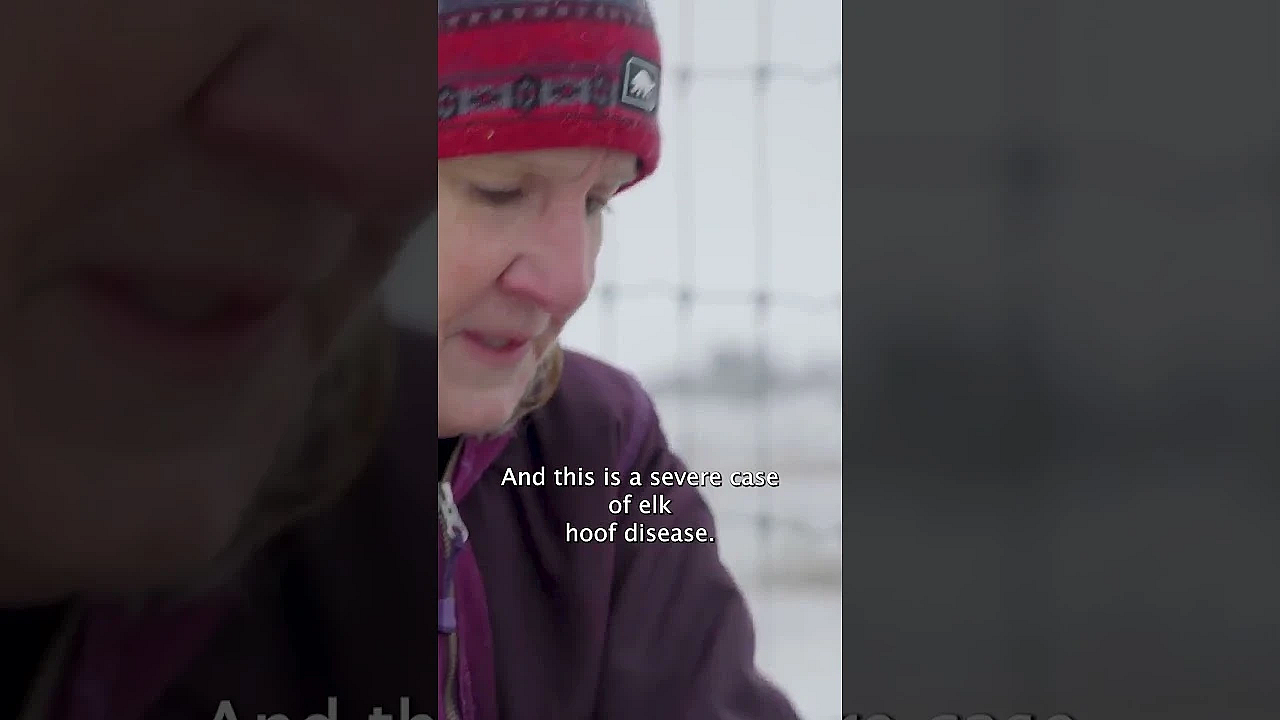 Cal Talks To An Expert About This Brutal Disease. Watch The Full Episode For More About Its Effects.