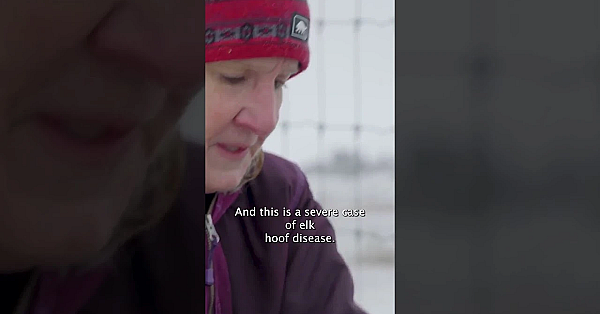 Cal Talks To An Expert About This Brutal Disease. Watch The Full Episode For More About Its Effects.