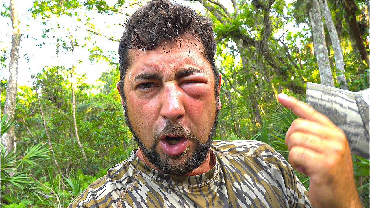 Hornets Attack Us! We Attacked Back!!!!