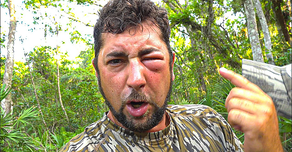 Hornets Attack Us! We Attacked Back!!!!