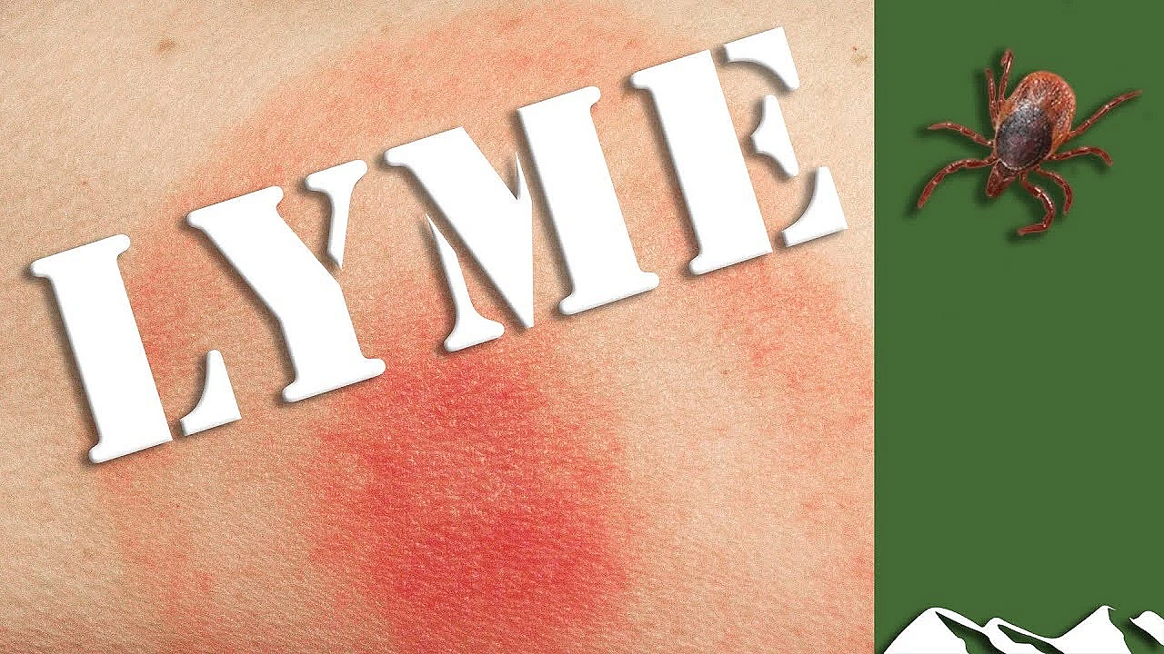 Life With Lyme Disease