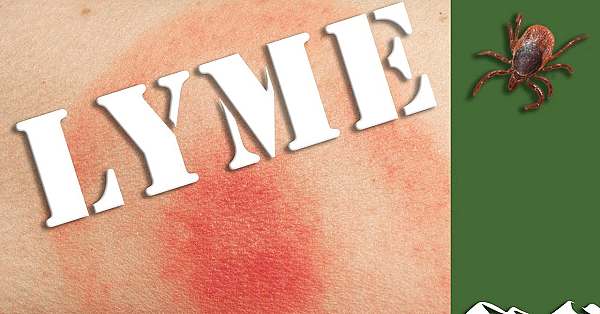 Life With Lyme Disease
