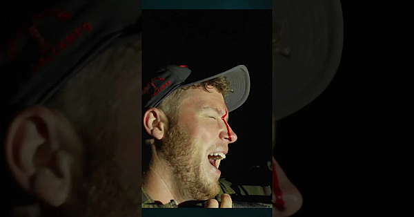 My Scar Of Incompetence